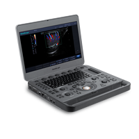 Système d'échographie Doppler couleur vétérinaire portable SonoScape X3V avec démarrage rapide pour animaux de compagnie