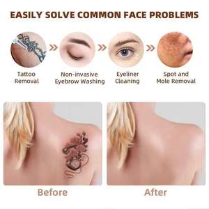 Équipement professionnel de lavage des sourcils haute puissance, instrument portable de suppression des taches de rousseur et des tatouages au picoseconde pour salon de beauté - Product Image 6