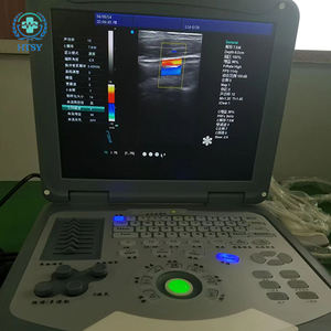 Escáner de Embarazo de Alta Resolución, Portátil, con Imágenes en Tiempo Real, de Gama Alta, Máquina de Ultrasonido Veterinario - Product Image 3