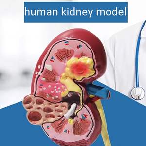 Modè<span class=keywords><strong>le</strong></span> de rein en sciences médicales, pathologie, double perspective avec rein <span class=keywords><strong>normal</strong></span> <span class=keywords><strong>et</strong></span> malade pour l'enseignement de l'anatomie <span class=keywords><strong>et</strong></span> de la physiologie humaine - Product Image 3