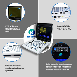 Sistema <span class=keywords><strong>de</strong></span> Diagnóstico por <span class=keywords><strong>Ultrasonido</strong></span> Completamente Digital en Blanco y Negro, Escáner <span class=keywords><strong>de</strong></span> <span class=keywords><strong>Ultrasonido</strong></span> B/N Hearto 120C con Pantalla LCD <span class=keywords><strong>de</strong></span> Alta Resolución <span class=keywords><strong>de</strong></span> 12 Pulgadas - Product Image 3