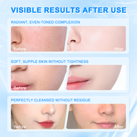 Nettoyant Visage Hydratant et Nourrissant aux Acides Aminés, Végétalien, à l'Acide Hyaluronique et Niacinamide, Contrôle du Sébum, Démaquillant Doux