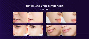 Appareil de soin du visage à bulles de CO2 portable 3 en 1, machine de soin du visage magique, hydratation du visage, machine à bulles de CO2 - Product Image 4