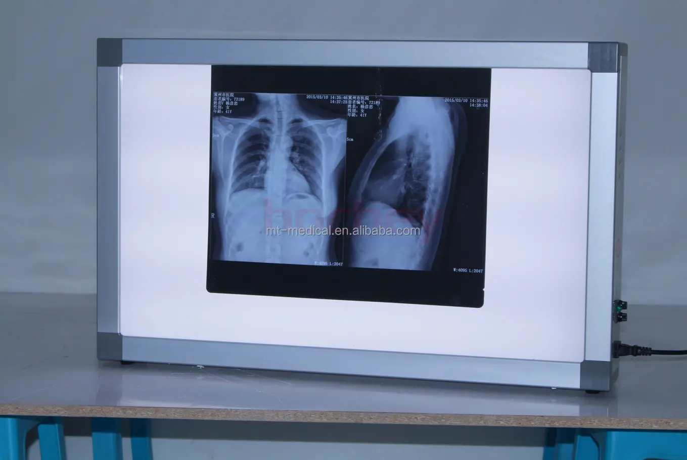 MT MEDICAL LED medical X-ray visualizzatore di pellicole a raggi X su un lato visualizzatore di pellicole a raggi X visualizzatore di pellicole