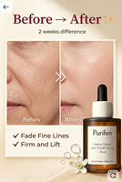 Esens Pelembap Wajah Bunga Sophora Japonica Formula Lembut Perawatan Kulit Perjalanan Serum Perawatan Khusus yang Menghaluskan