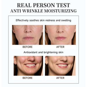 Réparation <span class=keywords><strong>de</strong></span> la peau du visage Dissolvant <span class=keywords><strong>anti</strong></span>-rides Mosturizer Crème <span class=keywords><strong>de</strong></span> pansement noire pour le visage - Product Image 3