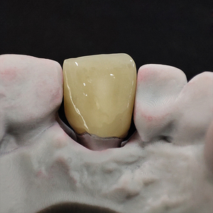 Tutti i denti di porcellana ceramica Zirconia corone impianto dentale produttore cina buon prezzo - Product Image 1