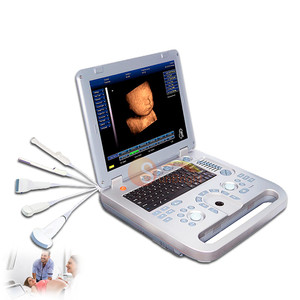 Escáner de Ultrasonido Médico Portátil LED 3D Totalmente Nuevo, Marca Windows System, Ultrasonido en Blanco y Negro SUN-<span class=keywords><strong>800D</strong></span> - Product Image 1