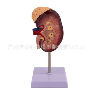 Modèle d'enseignement d'anatomie rénale grossi 2x, modèle réduit d'anatomie rénale humaine normale, avec glande surénalette - Product Image 2