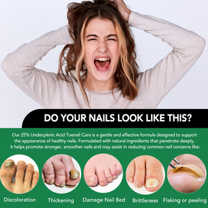 YECUCE 25% Undecylenic Extra Strength Solution pour l'élimination des mycoses des ongles, Sérum réparateur pour les ongles, Traitement des mycoses des ongles des orteils - Product Image 6