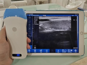 Meilleur prix pour un scanner linéaire sans fil noir et blanc à 128 éléments, équipement hospitalier, scanner linéaire, prix du scanner - Product Image 5