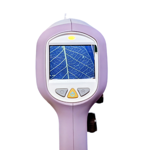 أحدث كاميرا فيديو إلكترونية محمولة من نواة المهبل منظار المهبل بالفيديو لأمراض النساء - Product Image 4