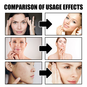 Mặt Kem & Lotion chống tuổi làm săn chắc làm mịn trẻ hóa giữ ẩm tinh chất collagen Kem vẻ đẹp để loại bỏ đốm đen - Product Image 5