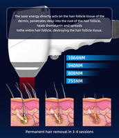 Boslaser Layar Pintar 12 Inci Laser Dioda 4 Gelombang untuk Epilasi dan Peremajaan Tanpa Rasa Sakit - Laser Dioda Layar Sentuh 808nm