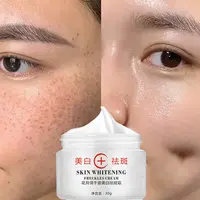 Whitening Cream, Dark Spot Remover, Face Pigment