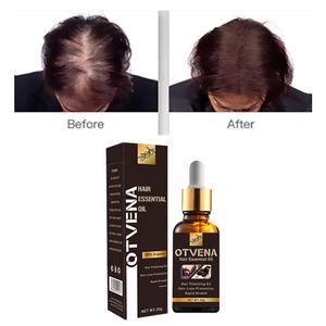 Otvena เซรั่มป้องกันผมร่วงสมุนไพรน้ำมันปลูกผมร่วงและศีรษะล้านจากขิงร่วง - Product Image 6