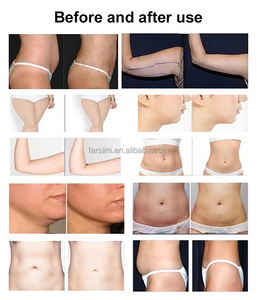 Đa chức năng OEM 2 trong 1 điều trị thoát bạch huyết mặt nâng cơ thể giảm béo cơ thể điêu khắc máy - Product Image 6