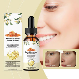 Grosir 100% murni alami organik kelas Premium <span class=keywords><strong>Frankincense</strong></span> minyak esensial untuk Diffuser dan Aromaterapi - Product Image 5