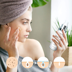 Suero Facial Líquido Corrector de Manchas Oscuras, Iluminador, Antienvejecimiento y Blanqueador con Ácido Kójico Orgánico de Marca Privada - Product Image 6