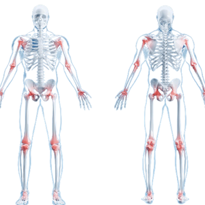 Barato Alemania Brasil proteína Original coreano piel blanqueamiento adelgazamiento vitamina C jugo colágeno polvo para damas arriba con Pro - Product Image 4