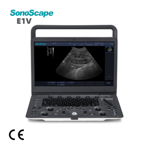 Ecógrafo Portátil Veterinario SonoScape E1V en Blanco y Negro, Máquina Digital <span class=keywords><strong>con</strong></span> Sonda <span class=keywords><strong>de</strong></span> Ultrasonido para Diagnóstico Animal y Uso Clínico - Product Image 1