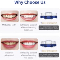 Poudre dentaire, sérum nettoyant pour l'hygiène buccale, gel blanchissant, soin des dents, blanchiment dentaire, outils dentaires, sourire parfait