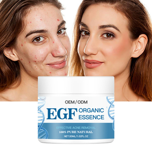 Crème réparatrice EGF Bio pour le traitement de l'acné, contrôle du sébum, réparation de la peau endommagée, atténuation des marques et des taches d'acné, oligopeptides, crèmeides OEM/ODM - Product Image 6