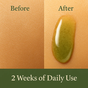 Huile de Tamanu Bio Non Raffinée Pressée à Froid Marque Blanche – Cicatrisante, Apaisante pour l'Acné, Réduit l'Inflammation – Huile de Graine de Tamanu - Product Image 4