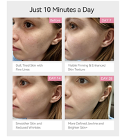 Appareil de rajeunissement facial 5-en-1 à microcourant EMS, outil de soin de la peau portable, batterie rechargeable, étanche, en plastique, pour le visage
