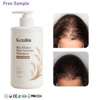 Joynna Care – Soin Capillaire Bio Végétalien Anti-Chute Sans Sel, Renouvellement au Ginseng, Formule Herbal Anti-Graisse au Phosphate pour Cheveux Affinés – Liquide Capillaire Mose