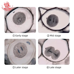 Portaobjetos de Microscopio Biológico para División Mitótica de Células Animales, Ascaris Equis, Corte Transversal del Útero, Genética - Product Image 6