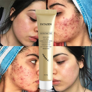 Crema Herbal para Eliminar Cicatrices OEM/ODM, Trata Cicatrices y Enrojecimiento, Promueve la Regeneración Celular, Previene la Cicatrización Hipertrófica, No Irritante - Product Image 2
