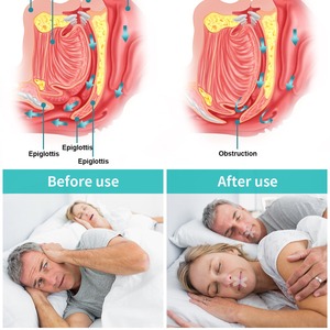 口を密封するためのカスタマイズされた口テープラテックスフリー粘着パッチより良い睡眠口テープいびきを止めるための睡眠ストリップ - Product Image 3