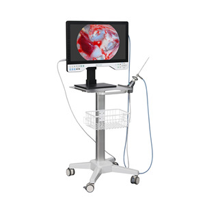 पेशेवर 24 "27" ऑल-इन-वन पोर्टेबल एंडोस्कोपी प्रणाली चिकित्सा निरीक्षण के लिए अंतर्निहित प्रकाश और लचीली गुंजाइश के साथ - Product Image 5