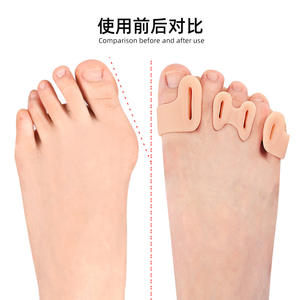Pemisah jari kaki lima lubang, valgus jempol besar tumpang tindih kaki orthotics lembut pengoreksi jempol kaki - Product Image 5