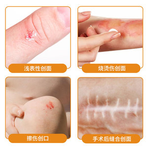 Apósito de gel de colágeno humano recombinante tipo III de Hk Dakaofang Medical para la cicatrización de heridas después de procedimientos cosméticos - Product Image 3