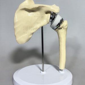 2025 New Chất lượng cao nhân tạo Vai Doanh chỉnh hình đào tạo mô hình đào tạo y tế mô hình - Product Image 3