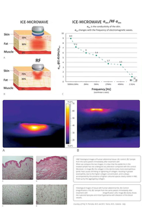 Instrumento Moldeador Corporal para Rostro, Brazos, Muslos y Glúteos - Product Image 3