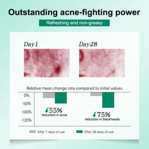 <span class=keywords><strong>ครีม</strong></span>ดูแลผิวครีมทาหน้าสิวสี<span class=keywords><strong>แดง</strong></span>รอยแผลเป็นป้องกันการอักเสบวิตามินอีว่านหางจระเข้ครีมรักษาสิวติดฉลากส่วนตัว - Product Image 5