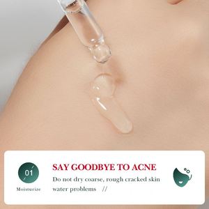 Sérum de soin de la peau SADOER Extrait d'<span class=keywords><strong>acide</strong></span> <span class=keywords><strong>salicylique</strong></span> de rose Traitement original de l'acné Éliminateur de points noirs Sérum de soin de la peau ordinaire - Product Image 5