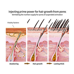 Champú y Acondicionador Natural Orgánico de Jengibre para el Crecimiento del Cabello y Contra la Caída del Cabello para Hombres y Mujeres - Product Image 3