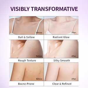 Vente chaude Soins du corps pour hommes Lotion hydratante en profondeur Nicotinamide <span class=keywords><strong>Lait</strong></span> Enlever la peau morte Lotion blanchissante pour le corps lisse de Chine - Product Image 5
