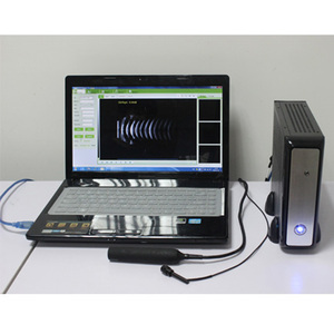 SAB-200 <span class=keywords><strong>Ultrasound</strong></span> pemindai A/B oftalmic - Product Image 2
