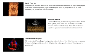 Sonoscape P20 Maquinas De Ultrasonido Medico <span class=keywords><strong>3d</strong></span> <span class=keywords><strong>4d</strong></span> 5d Ultrasone Kleur <span class=keywords><strong>Doppler</strong></span> - Product Image 3