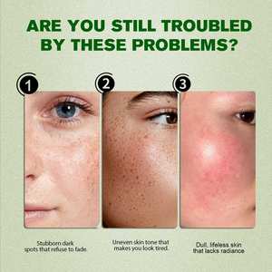 سيروم تفتيح الوجه المرطب والمصحح للبقع الداكنة لإشراقة البشرة مناسب لجميع أنواع البشرة - Product Image 3