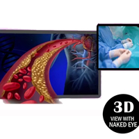 Lecteur de publicité 3d à œil nu Résolution HD 4k Moniteur d'affichage portable 3D sans lunettes