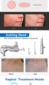 Non-Invasive Anti-Aging Skin Care CO2 Oxygen Micro-current Plastic ABS Face Lift No Needle Beauty Desktop Acne Scar Removal - Product Image 5