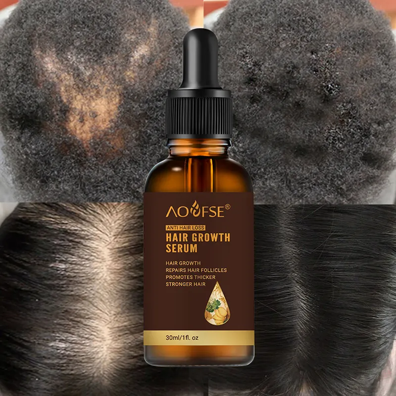 Label Pribadi Herbal Organik Minyak Pertumbuhan Rambut Jahe Anti-rambut Rontok Serum Pertumbuhan Rambut Alami