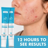 Crème Réparatrice Rapide et Efficace pour Cicatrices d'Acné à l'Acide Salicylique – Anti-Taches, Resserre les Pores, Lisse la Peau