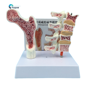 Modèle d'anatomie de l'ostéoporose du fémur humain PVC jambe os coupe transversale tranche vertébrale pathologique vertèbres lombaires pour la science médicale - Product Image 1
